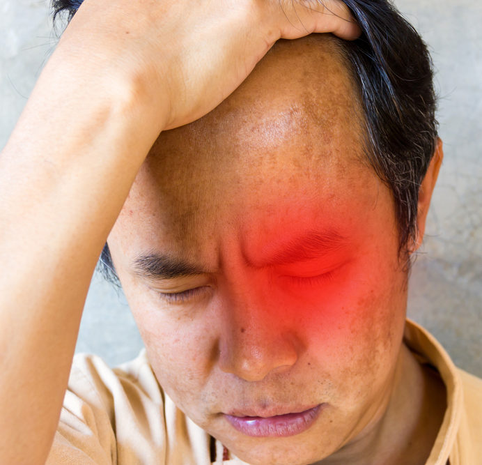 MAN HOLDING HIS HEAD SUFFERING FROM Trigeminal Autonomic Cephalgia
